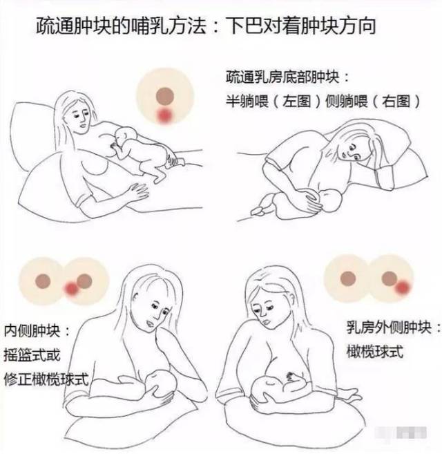 產(chǎn)后漲奶，疼痛難忍怎么辦？