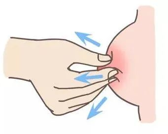 大乳頭、小乳頭、扁平乳頭、凹陷乳頭3大喂養(yǎng)指導(dǎo)及護(hù)理指南！