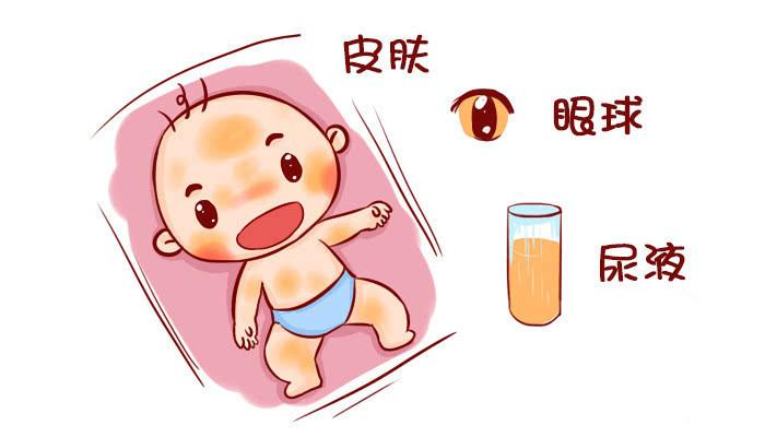 新生兒出生沒(méi)黃疸，大多是孕媽在孕期做了3件事