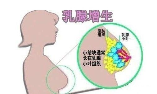 乳房出現(xiàn)“青筋”是什么原因呢？