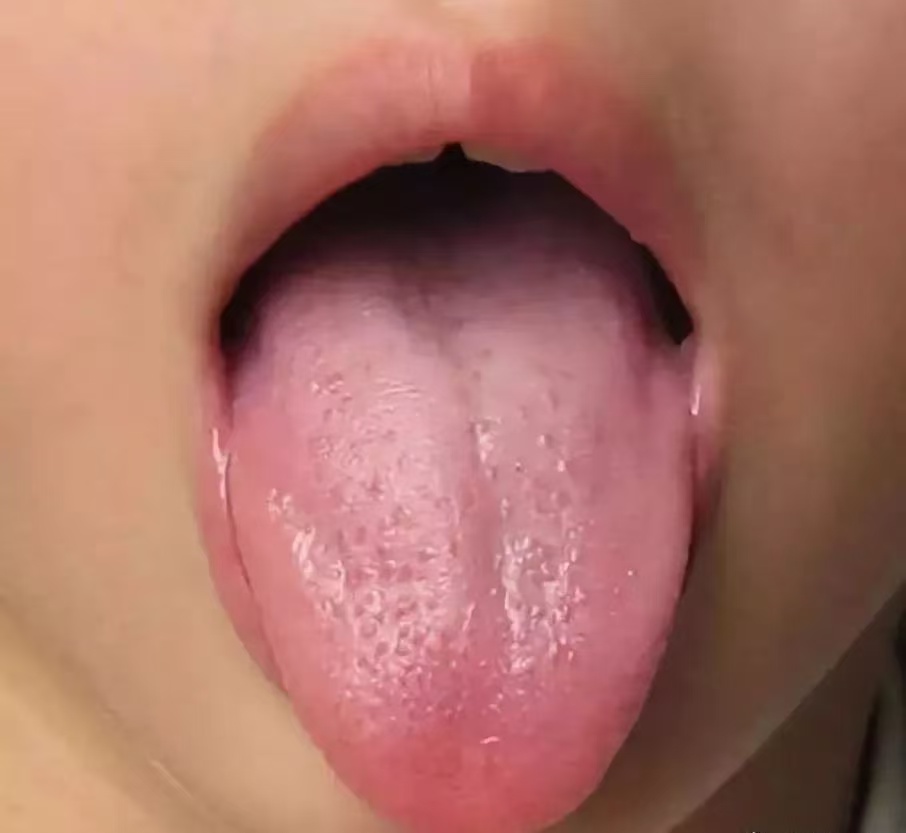 過度喂養(yǎng)危害大，寶寶發(fā)出的積食信號你能看懂多少？