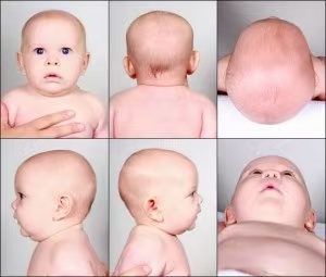 育兒小妙招|4個小妙招，幫寶寶睡出好頭型，趕緊收藏